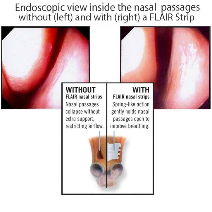Flair Equine Nasal Strips Single Strip Single Strip - FG Pro Shop Inc.